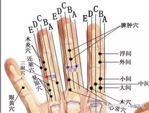 雙龍穴|董氏七十二绝针详解